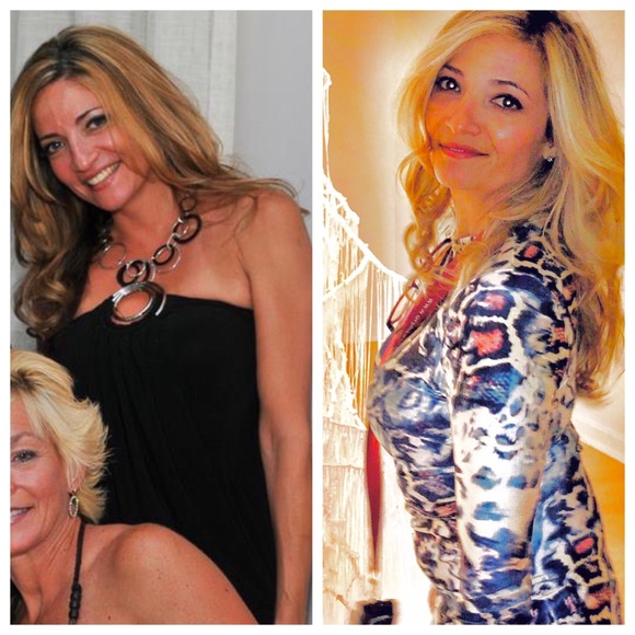 all brands Dresses & Skirts - SOLD Club party mini sexy Dress Bundle of 5 EUC